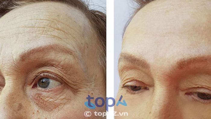 Thăm khám và tư vấn kỹ càng trước khi thực hiện