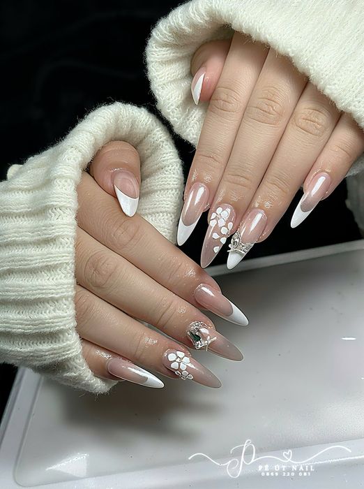PÉ ÚT NAIL Hình 1