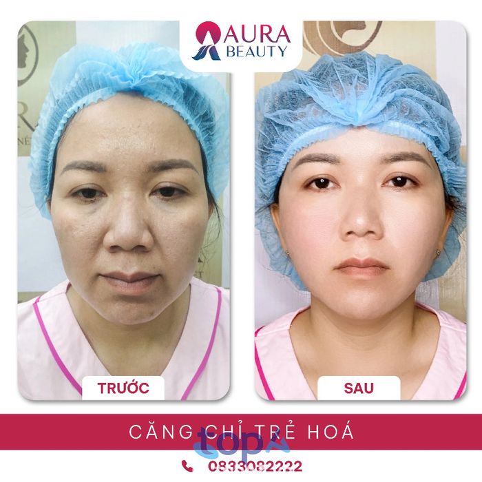 Thẩm mỹ viện Quốc tế Aura – P. Hòa Hưng