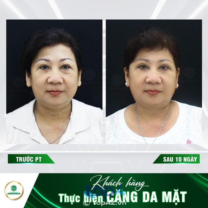 Bệnh viện Thẩm mỹ Ngô Mộng Hùng – P. Bàn Cờ