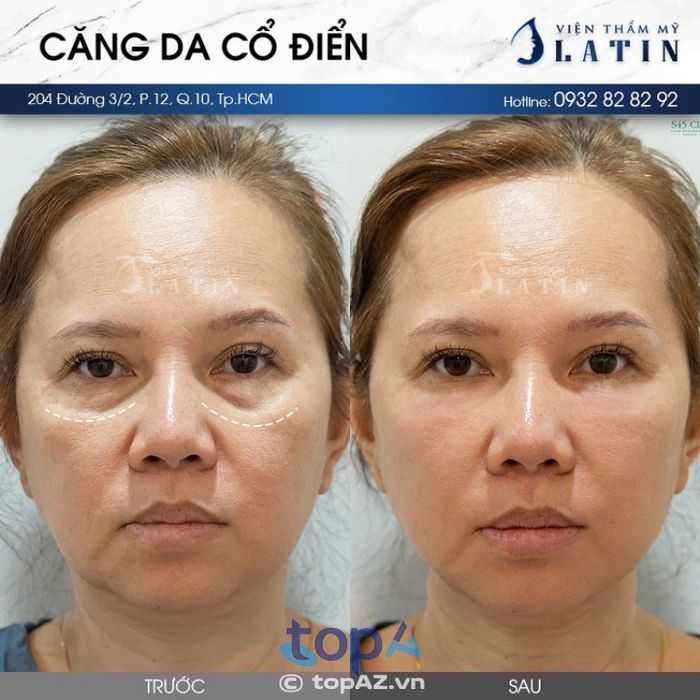 Phòng Khám Thẩm Mỹ LATIN – P. Hoà Hưng