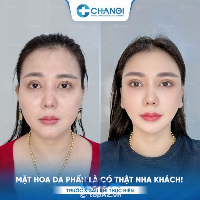 Phòng khám Thẩm mỹ CHANGI – Quận Tân Định