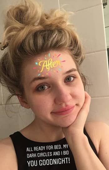 Maitland's face after cleansing with the Luna Mini 2