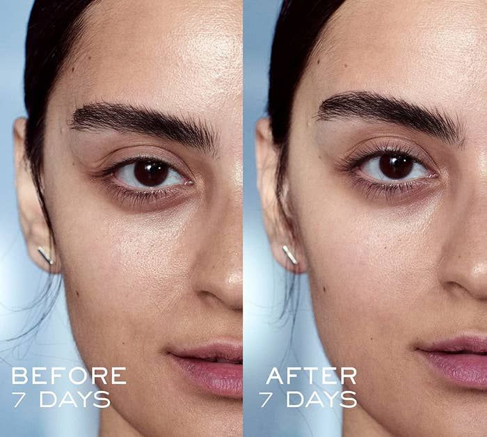 A model showing a before-and-after comparison of using the product