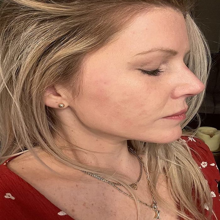 The transformation of a reviewer's skin after incorporating Vanicream into their routine