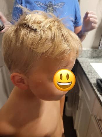 A child with naturally blond hair