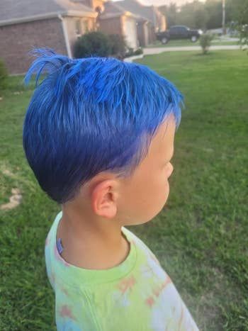 The same child now rocking vibrant blue hair
