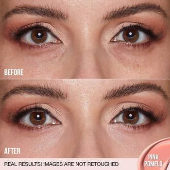 A close-up comparison of eyes before and after using the product.