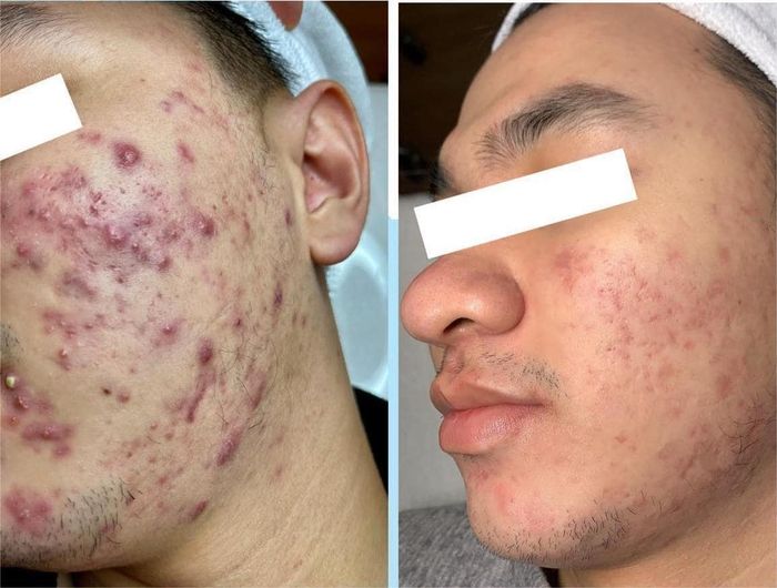 Ẩm Spa & Clinic