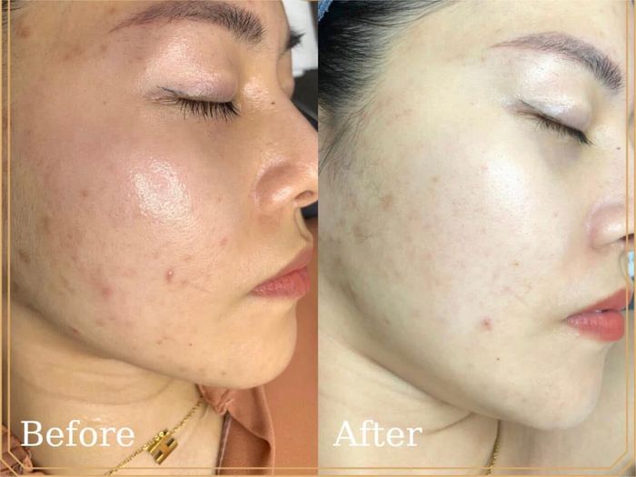 Hải Anh Beauty Center