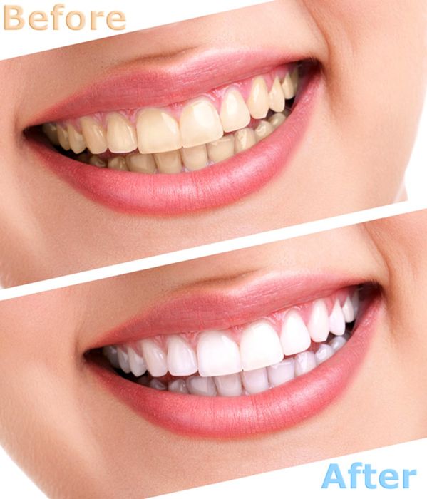 Phòng Khám Răng Hàm Mặt - Bác Sĩ Quỳnh Hoa: An Toàn và Chất Lượng