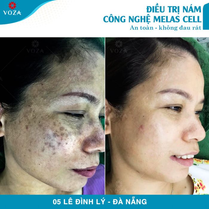 Thẩm mỹ viện Voza