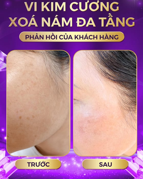 Spa Cao Bằng