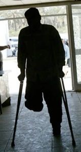 Amputee200605