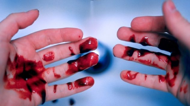 Bleeding