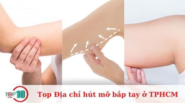 Những địa chỉ hút mỡ bắp tay hàng đầu tại TPHCM đảm bảo an toàn và uy tín