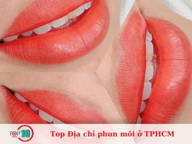 Thẩm Mỹ Nắng Mai - Chuyên gia phục hồi nét duyên đôi môi