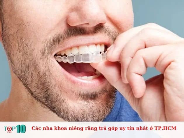 Những nha khoa niềng răng trả góp uy tín nhất tại TP.HCM