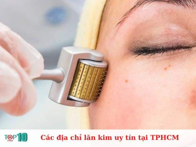 Các địa chỉ lăn kim uy tín tại TPHCM