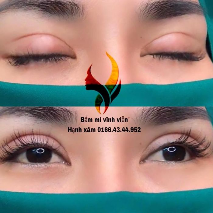 Top 3 Địa chỉ nhấn m&iacute;, cắt m&iacute; đẹp v&agrave; an to&agrave;n nhất Bi&ecirc;n H&ograve;a, Đồng Nai -  toplist.vn